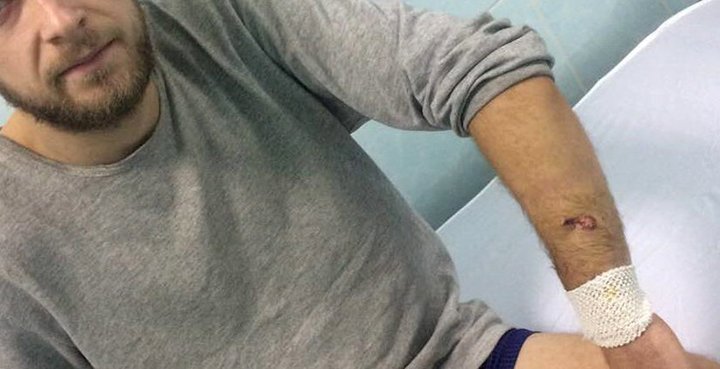 У с. Гора невідомий обстріляв з короткоствольної зброї  депутата сільської ради