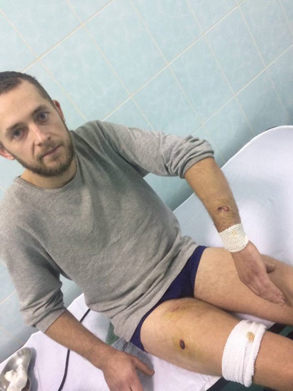 У с. Гора невідомий обстріляв з короткоствольної зброї  депутата сільської ради