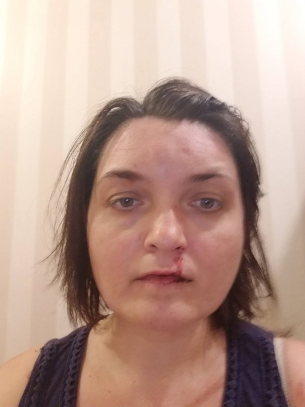 У с. Гора чоловік пляшкою розбив голову своєму сину У с. Гора чоловік пляшкою розбив голову своєму сину