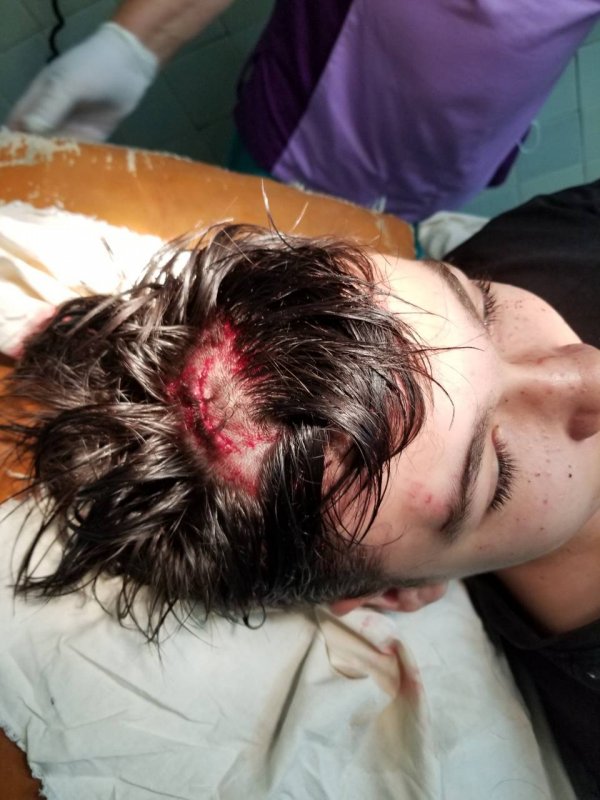 У с. Гора чоловік пляшкою розбив голову своєму сину У с. Гора чоловік пляшкою розбив голову своєму сину