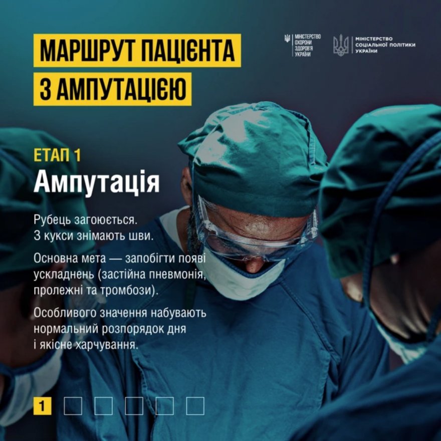 Допомога при ампутації: у МОЗ розповіли про етапи лікування та реабілітації Допомога при ампутації: у МОЗ розповіли про етапи лікування та реабілітації