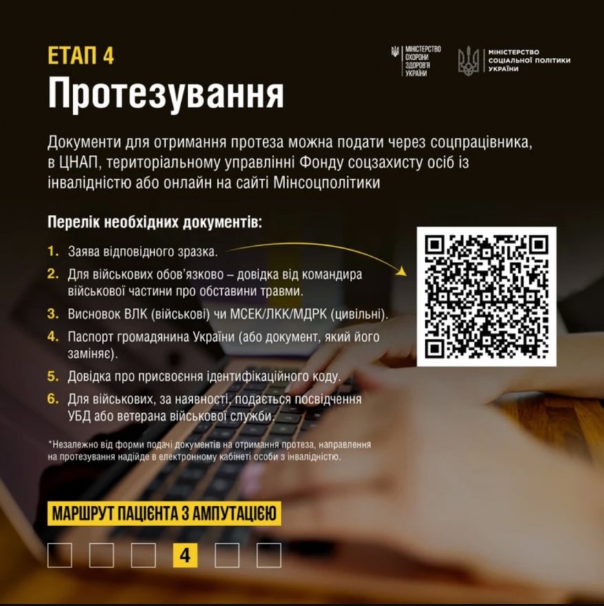 Допомога при ампутації: у МОЗ розповіли про етапи лікування та реабілітації Допомога при ампутації: у МОЗ розповіли про етапи лікування та реабілітації