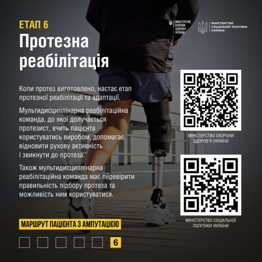 Допомога при ампутації: у МОЗ розповіли про етапи лікування та реабілітації Допомога при ампутації: у МОЗ розповіли про етапи лікування та реабілітації